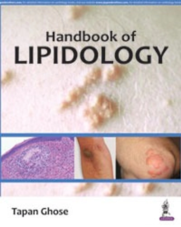 HANDBOOK OF LIPIDOLOGY - 9789352501953, TAPAN GHOSE, JAYPEE, HARDBOUND