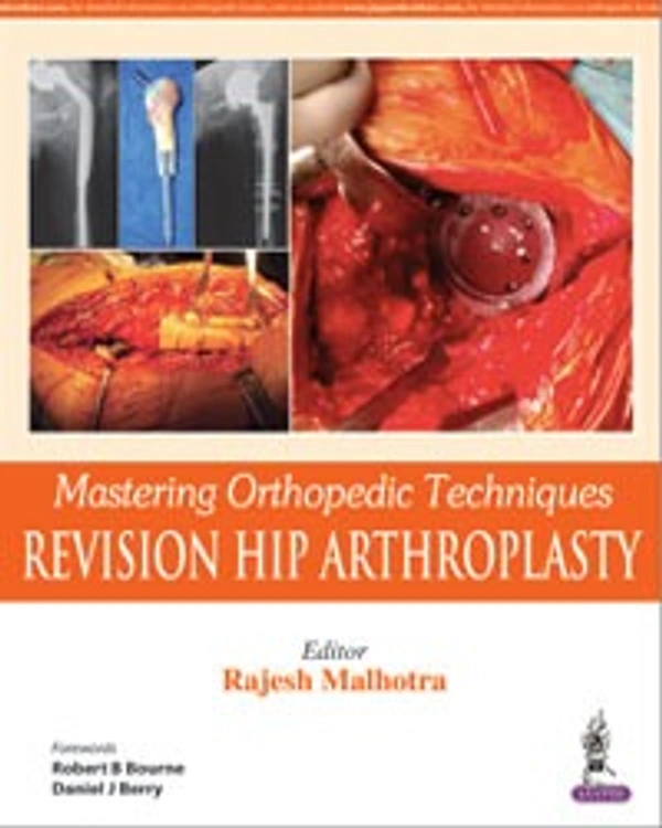MASTERING ORTHOPEDIC TECHNIQUES REVISION HIP ARTHROPLASTY - 9789351524861, RAJESH MALHOTRA, JAYPEE, PAPERBACK
