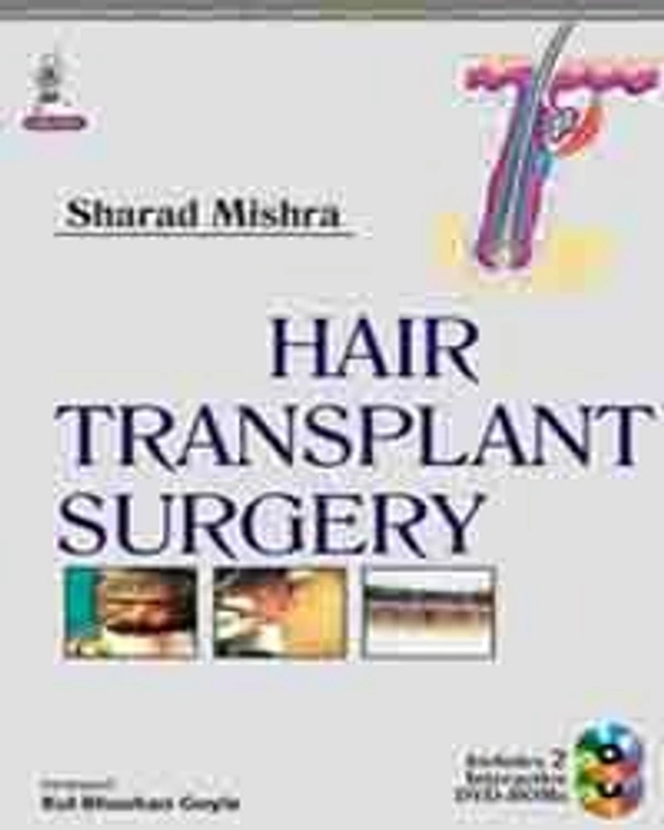 HAIR TRANSPLANT SURGERY - 9789351520795, SHARAD MISHRA, JAYPEE, PAPERBACK