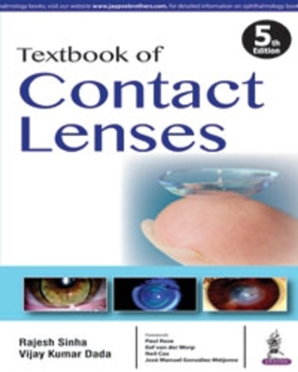 TEXTTBOOK OF CONTACT LENSES - 9789386150448, RAJESH SINHA, JAYPEE
