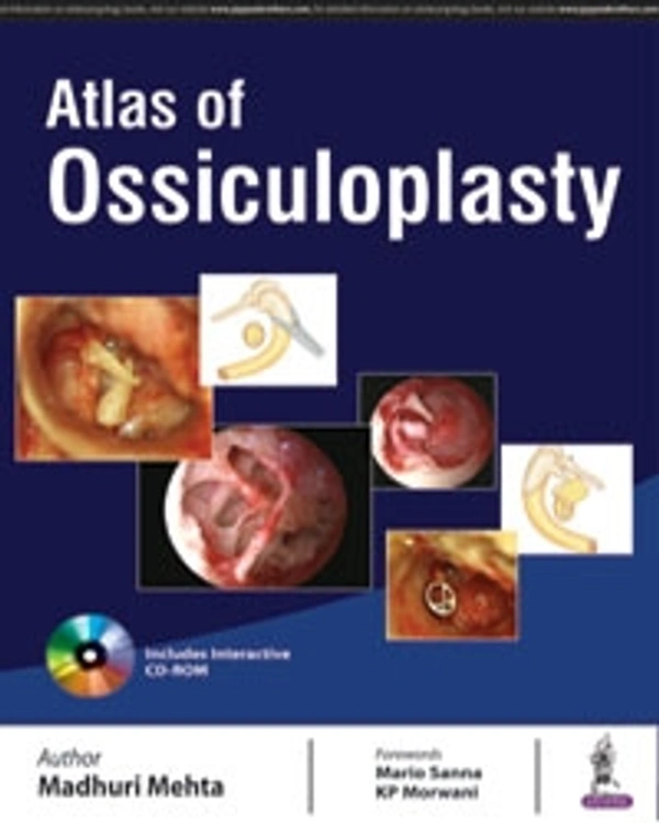 ATLAS OF OSSICULOPLASTY - 9789386150585, MADHURI MEHTA, JAYPEE