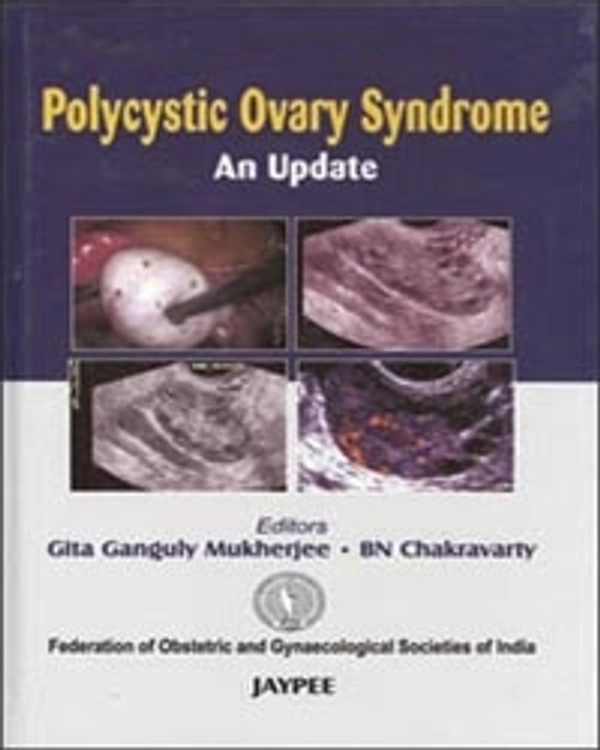 POLYCYSTIC OVARY SYNDROME AN UPDATE (FOGSI) - 9788180619892, MUKHERJEE, JAYPEE, PAPERBACK