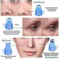 Derma Suction Blackhead Remover