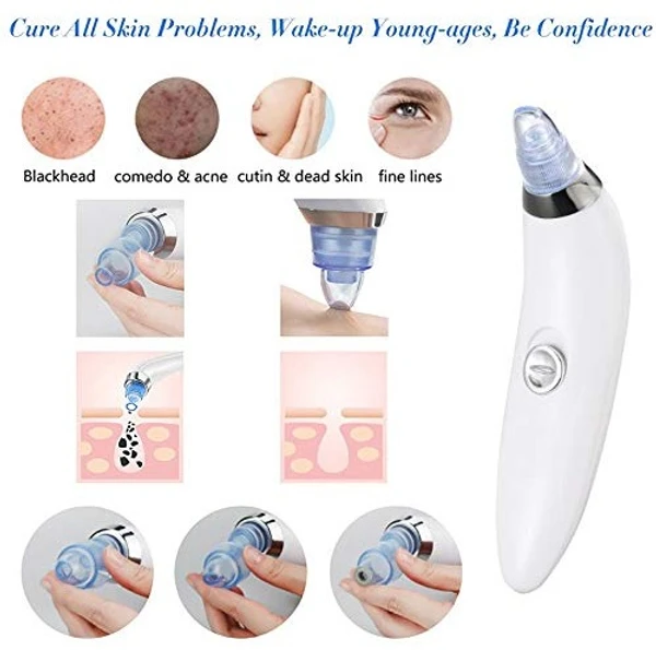 Derma Suction Blackhead Remover