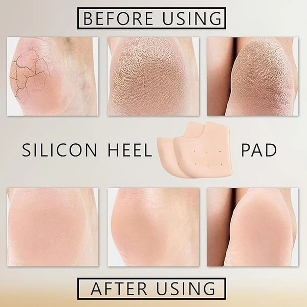 ANTI HEEL CRACK 300PB