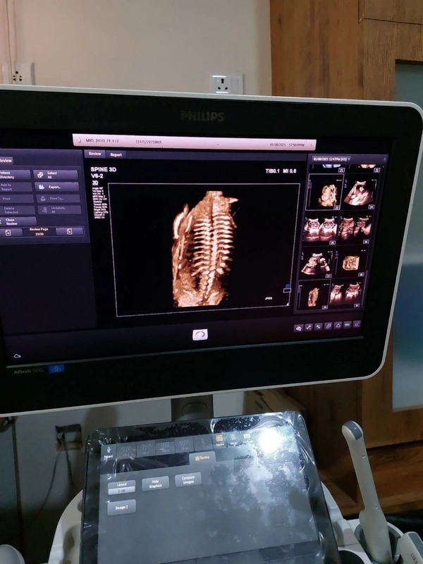 Philips Affinity 50 Ultrasound Color Doppler - Static / Mobile, White