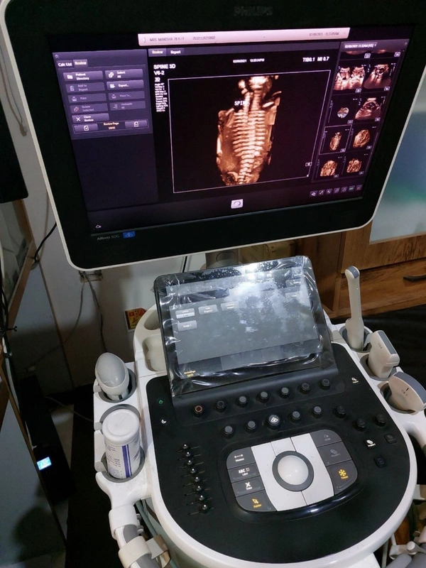 Philips Affinity 50 Ultrasound Color Doppler - Static / Mobile, White