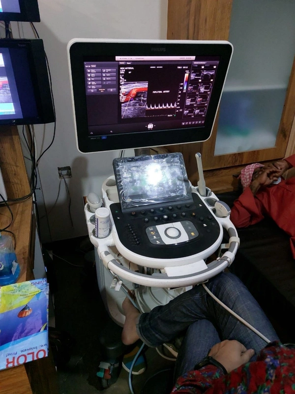 Philips Affinity 50 Ultrasound Color Doppler - Static / Mobile, White